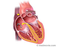 Diagram of the heart