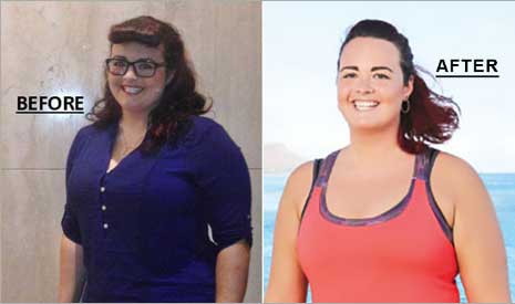 Kayla Before and After Non-Surgical Weightloss