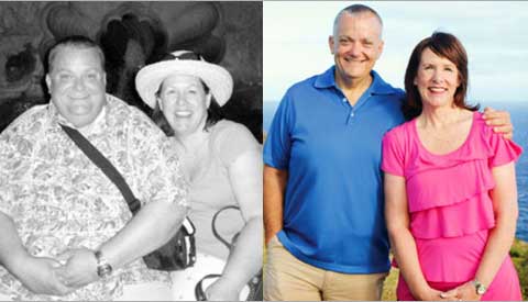 Tracey and James Before and After Gastric Bypass Surgery